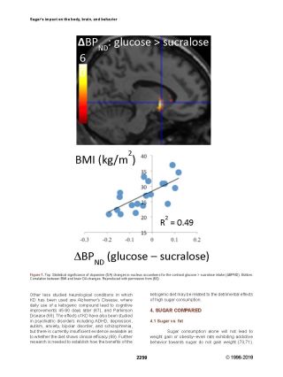 MRI activation map (glucose>sucralose) with scatter plot of BMI vs ΔBPND, R²=0.49