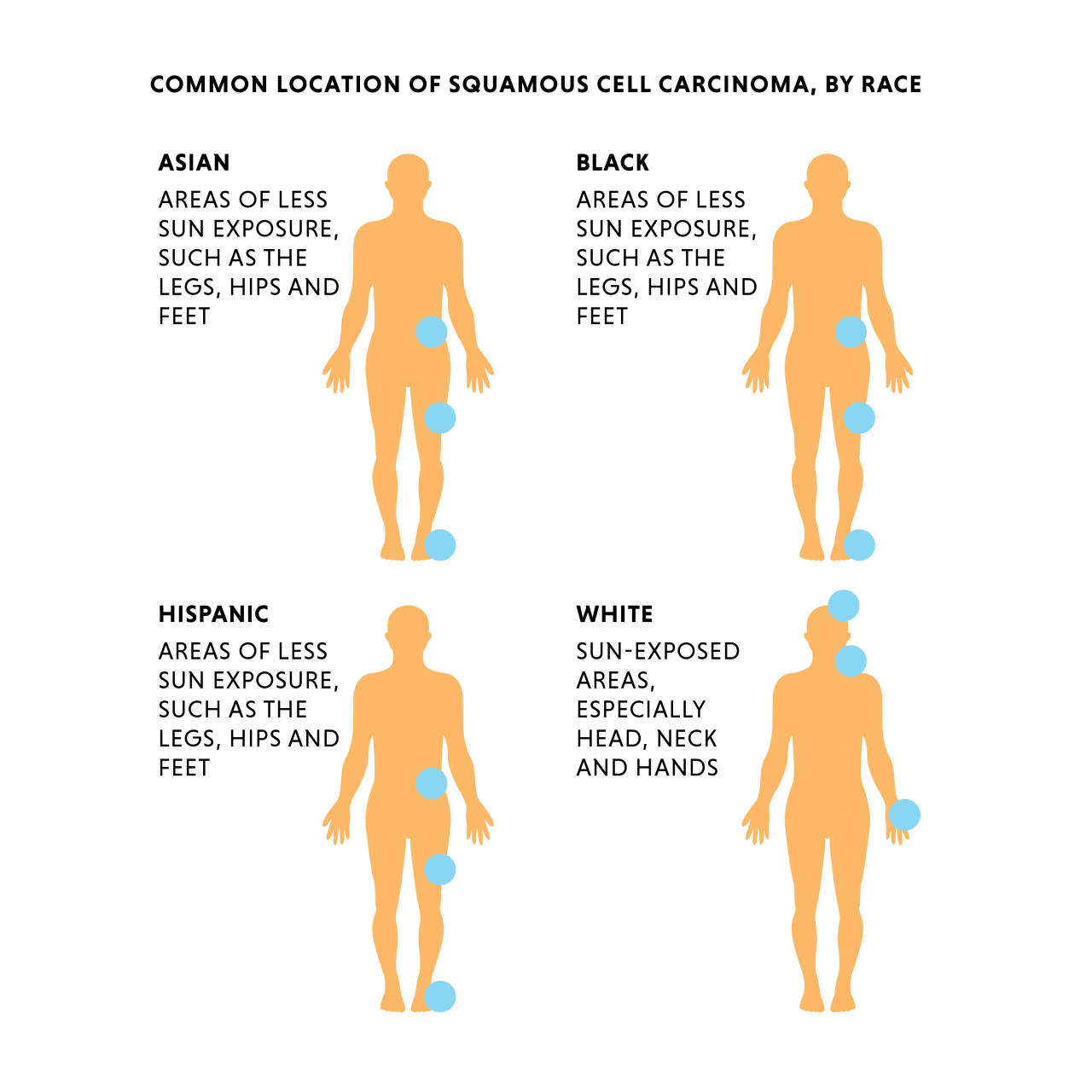 Locations of where SCC targets by race