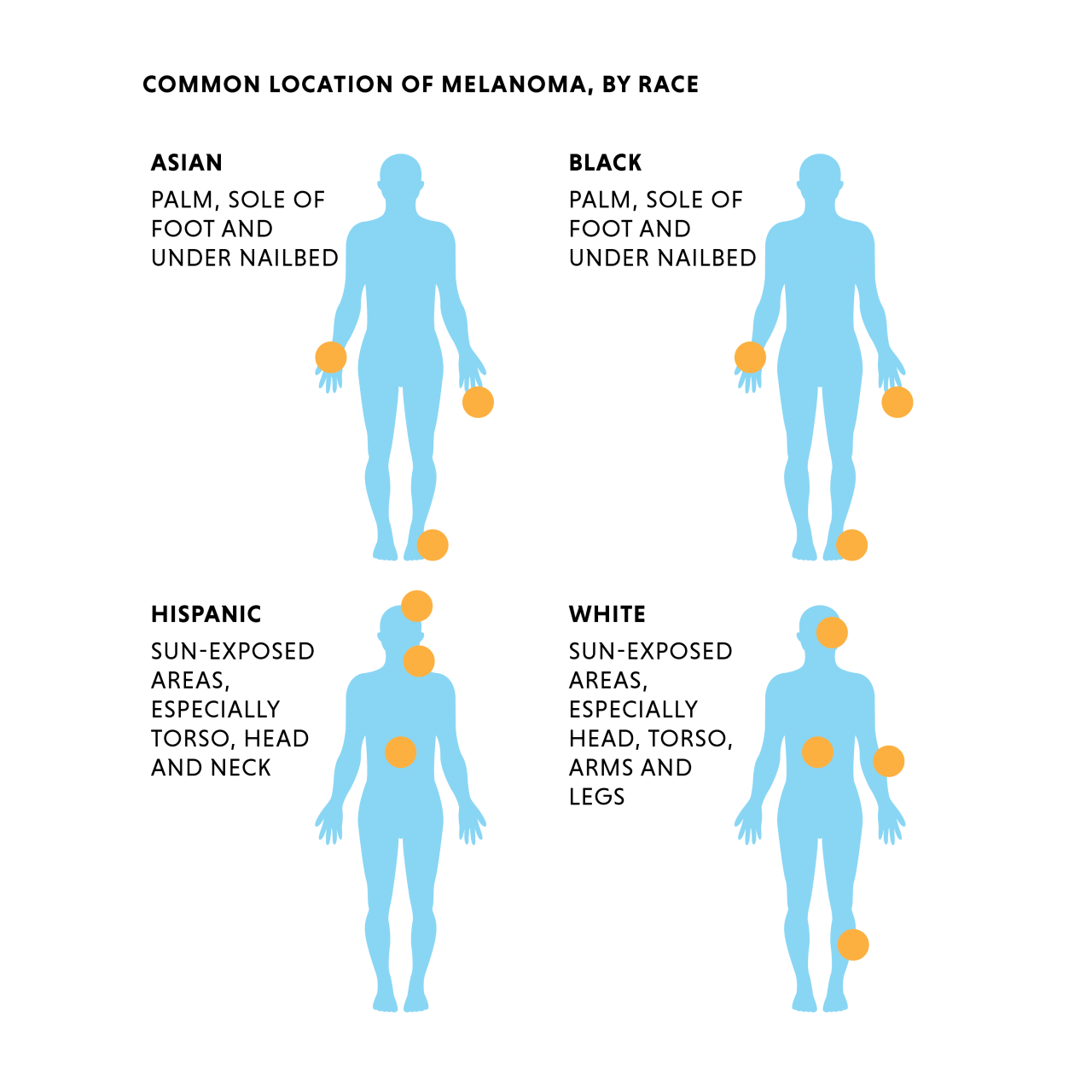 Locations of where melanoma targets by race